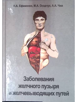 Заболевания желчного пузыря и желчевыводящих путей