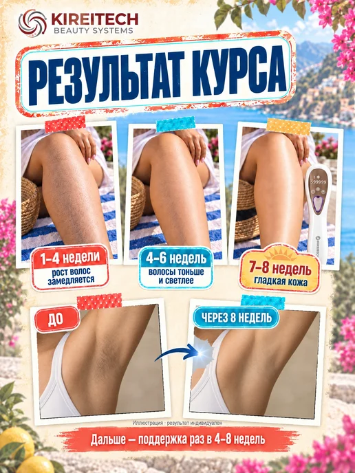 KireiTech Фотоэпилятор лазерный женский для удаления волос, охлаждение, вариант, фото 3
