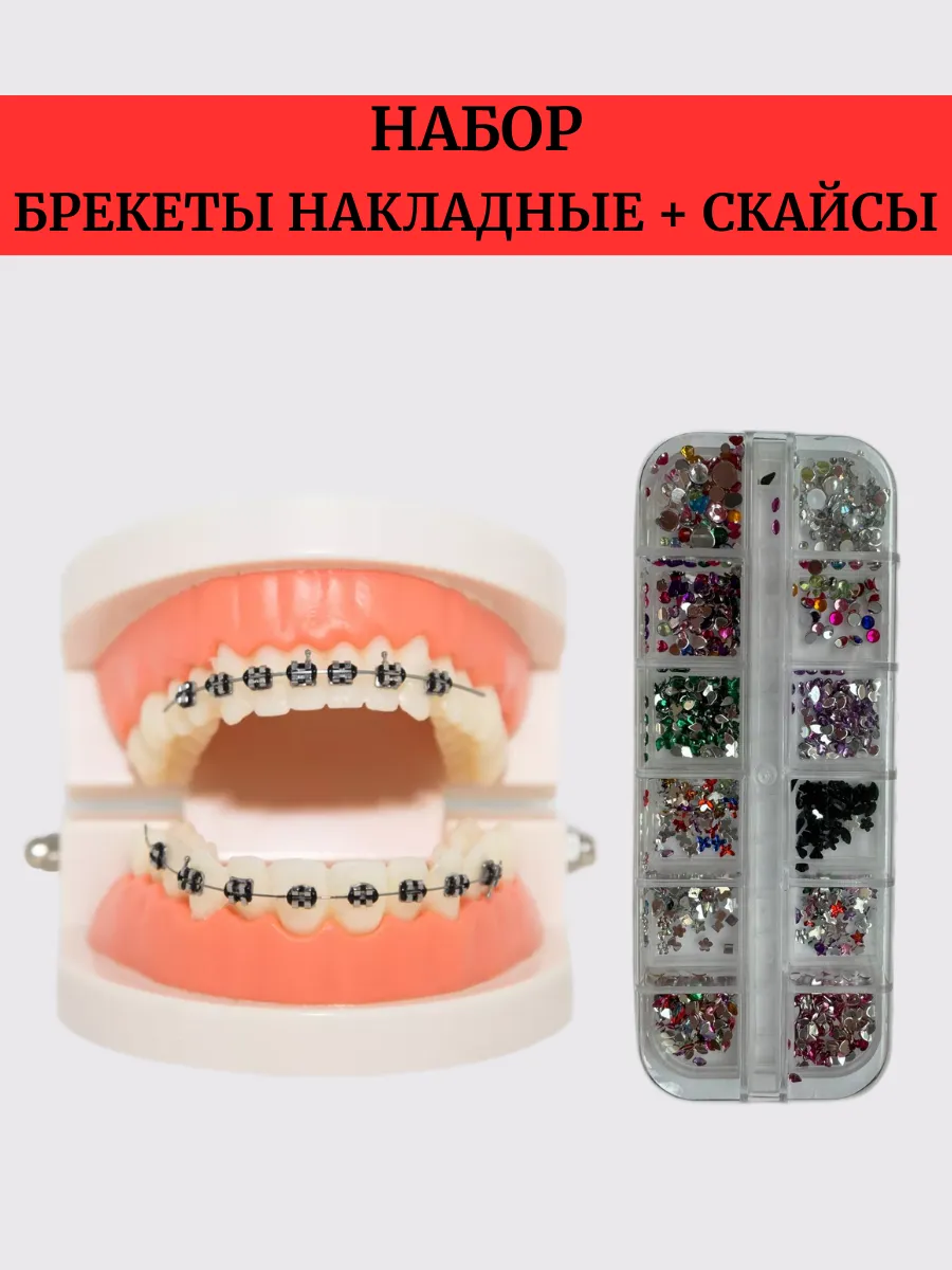 Набор брекеты накладные...