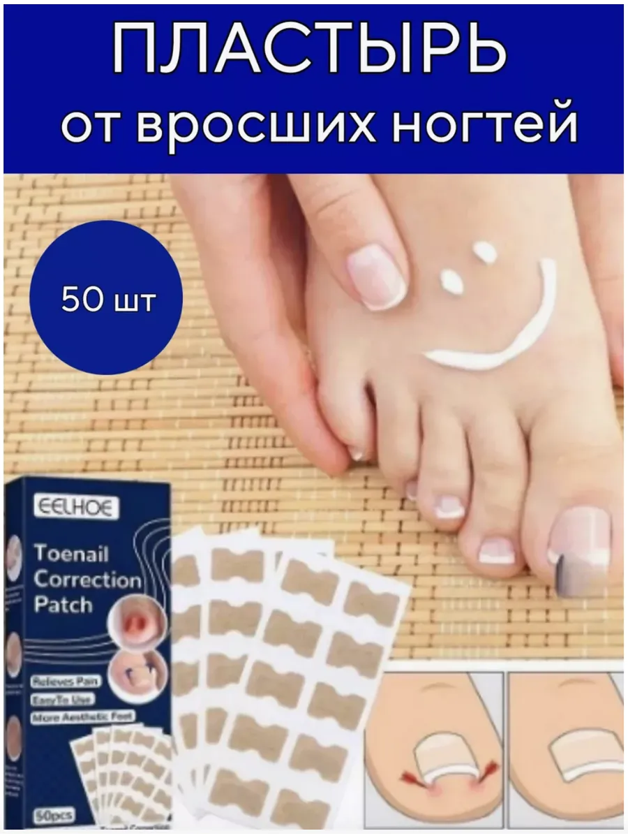 Пластырь от вросших ногтей...
