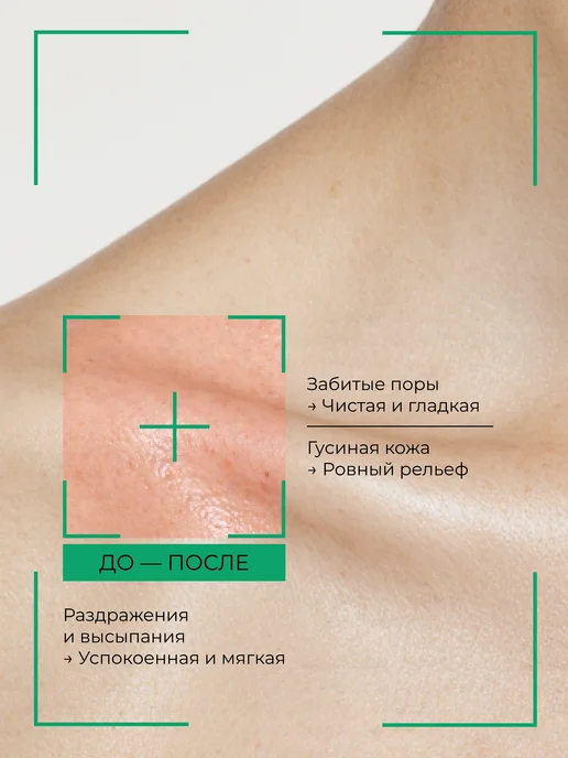 Some by mi Гель для душа с кислотами AHA, BHA, PHA от прыщей, вариант, фото 2