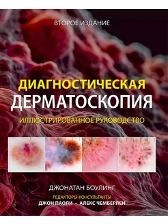 Диагностическая дерматоскопия