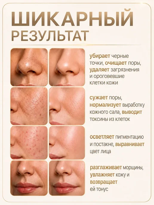 LUXLIFTING Аппарат ультразвуковой чистки лица от черных точек с гелем, черный, фото 4