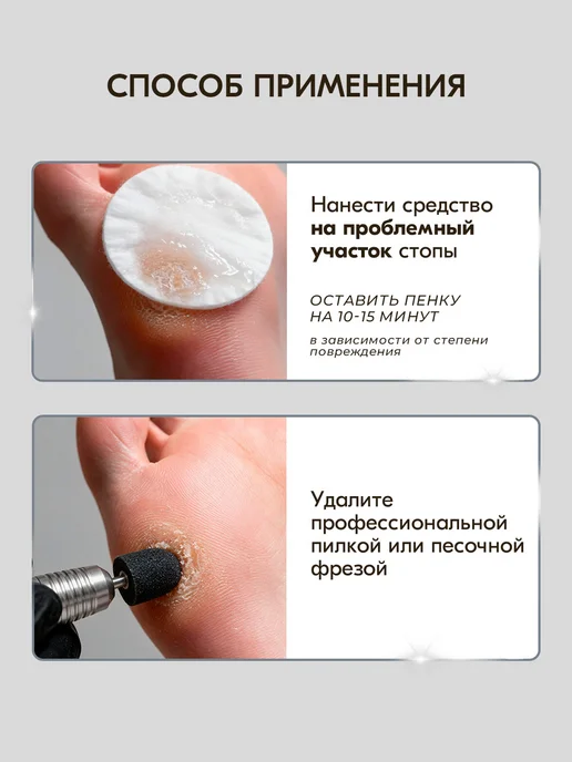 INKI Размягчитель для пяток, мозолей и натоптышей деликатный, вариант, фото 4