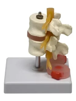человеческая модель поясничного отдела позвоночника