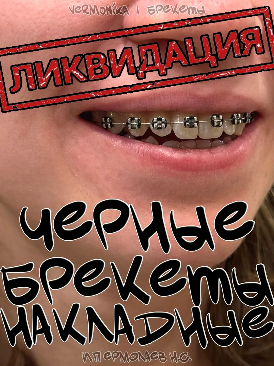 Брекеты накладные...
