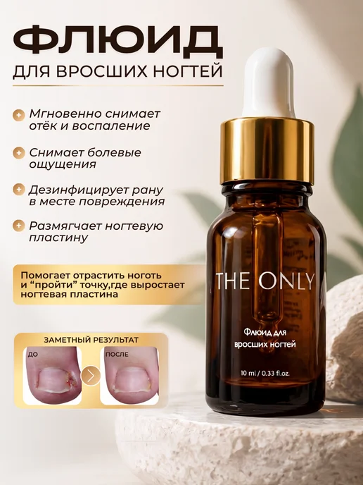 THE ONLY Средство от вросших ногтей Педикюр Кератолитик Флюид, вариант