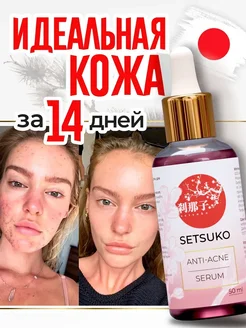 Сыворотка от прыщей и черных точек уходовая с ниацинамидом SetSuko Anti-Acne 278311544 купить за 727 ₽ в интернет-магазине Wildberries