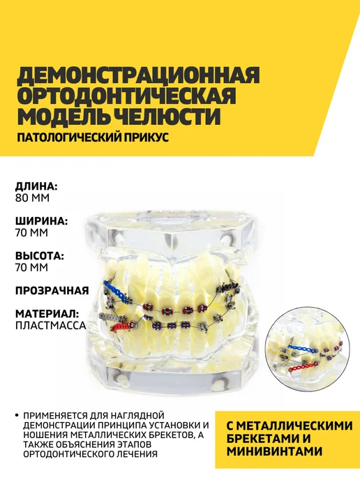 Dentins Демонстрационная модель челюсти с металлическими брекетами, вариант