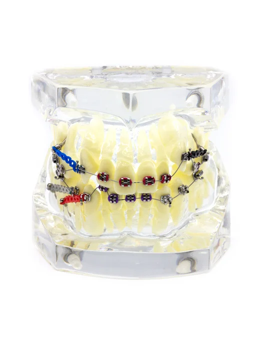Dentins Демонстрационная модель челюсти с металлическими брекетами, вариант, фото 2