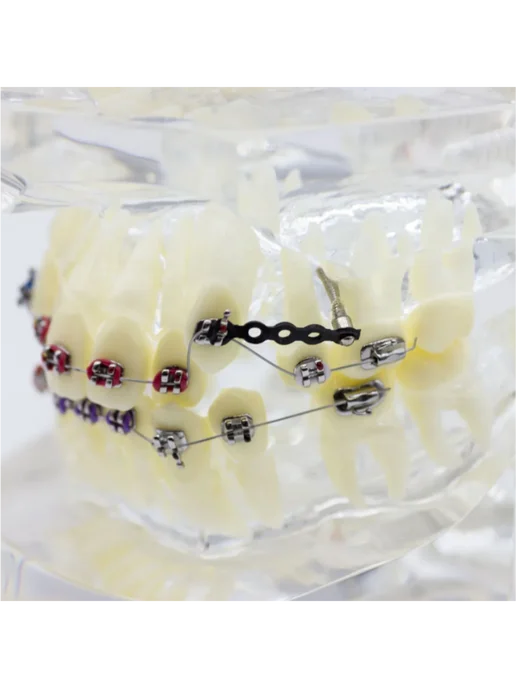 Dentins Демонстрационная модель челюсти с металлическими брекетами, вариант, фото 3