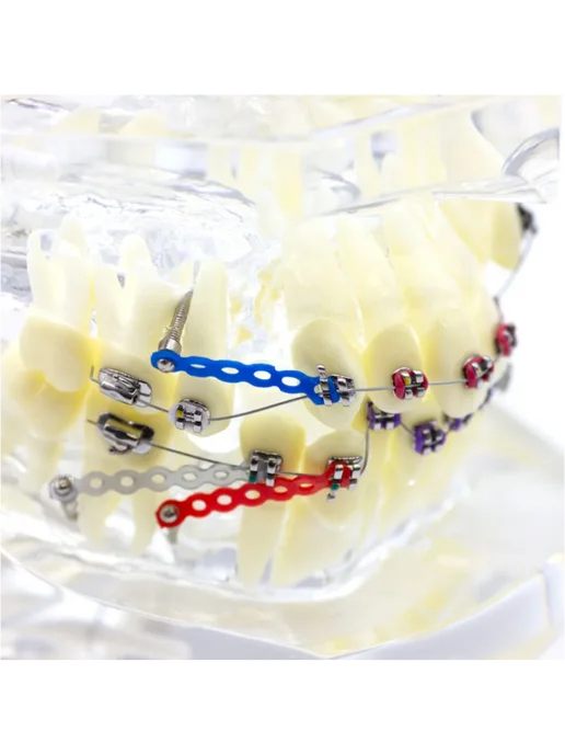 Dentins Демонстрационная модель челюсти с металлическими брекетами, вариант, фото 4