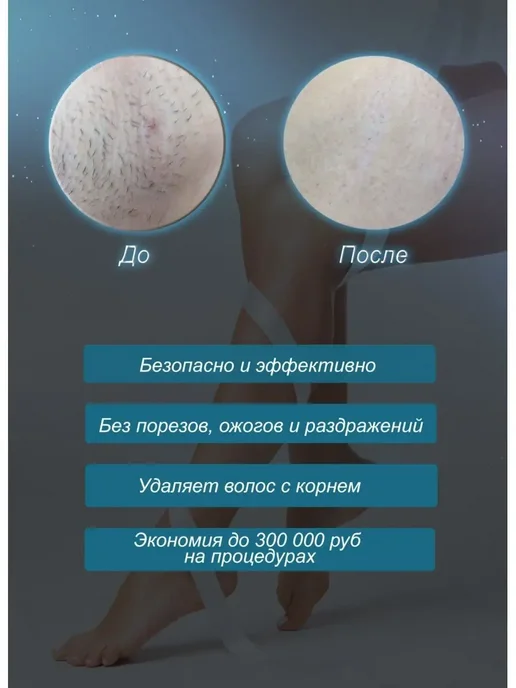 LKK Фотоэпилятор для лица и тела, белый, фото 7